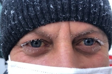 Kars’ta soğuktan vatandaşın kirpikleri buz tuttu